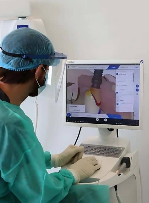 dental implants Marbella