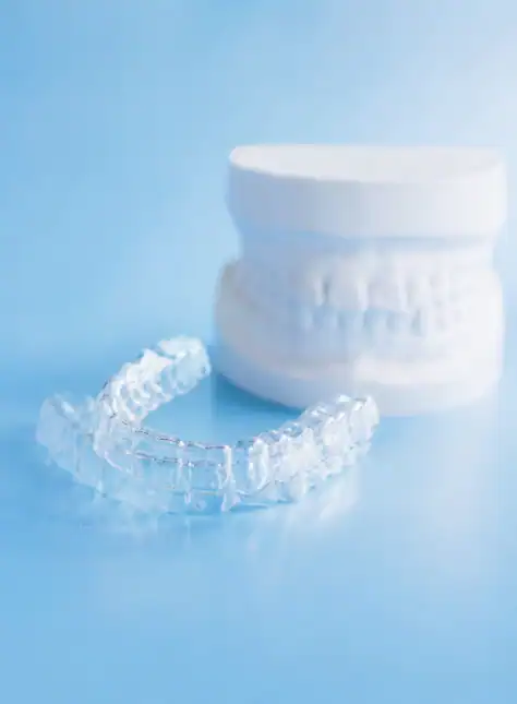 Molde y alineador de Invisalign Marbella