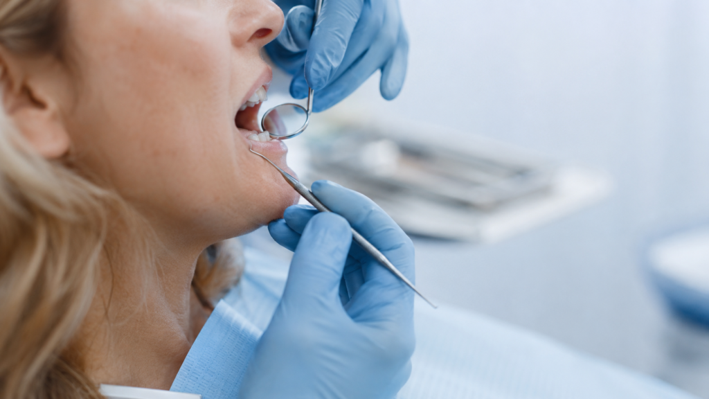 implantes dentales Marbella